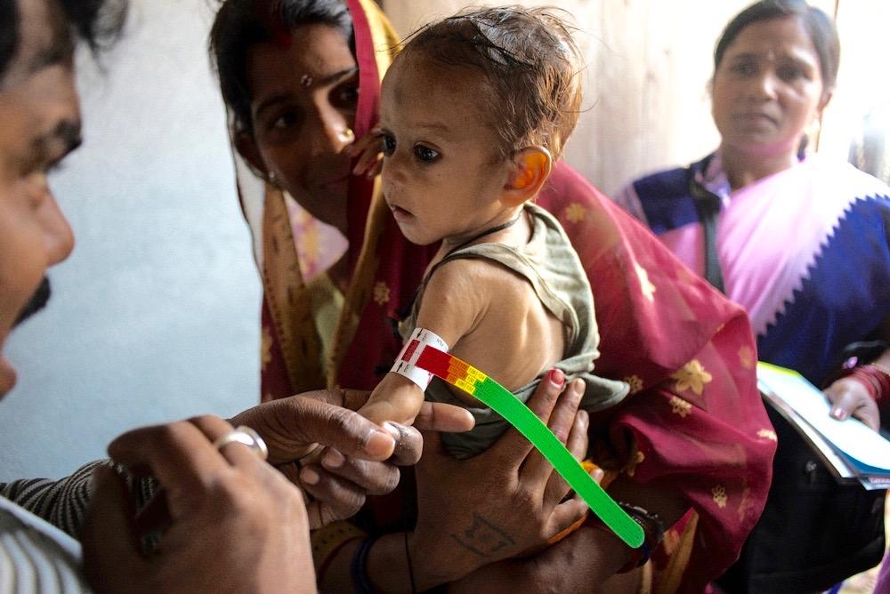 South Asian child is tested for malnutrition