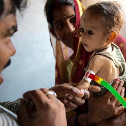 South Asian child is tested for malnutrition